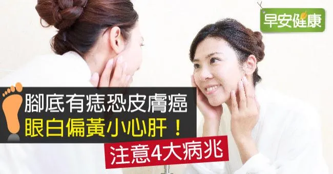 腳底有痣恐皮膚癌、眼白偏黃小心肝！注意4大病兆