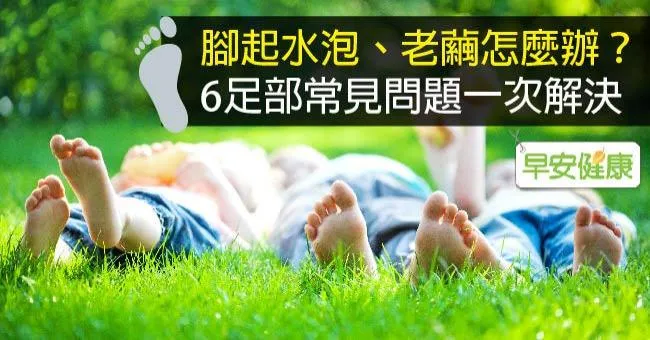腳起水泡、老繭怎麼辦？6足部常見問題一次解決