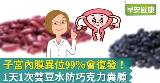子宮內膜異位99％會復發！1天1次雙豆水防巧克力囊腫