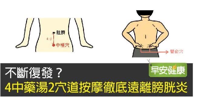不斷復發？4中藥湯2穴道按摩徹底遠離膀胱炎
