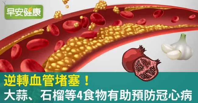 逆轉血管堵塞！大蒜、石榴等4食物有助預防冠心病