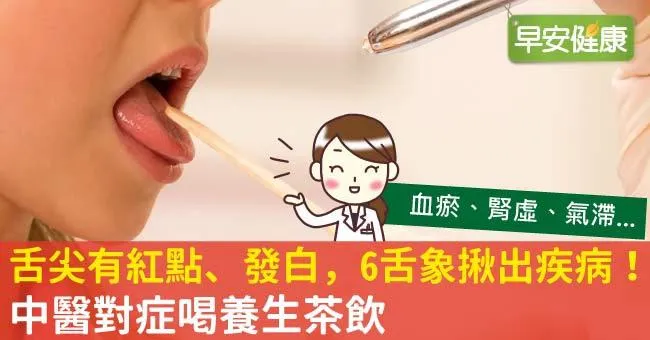 舌尖有紅點、發白，6舌象揪出疾病！中醫對症喝養生茶飲