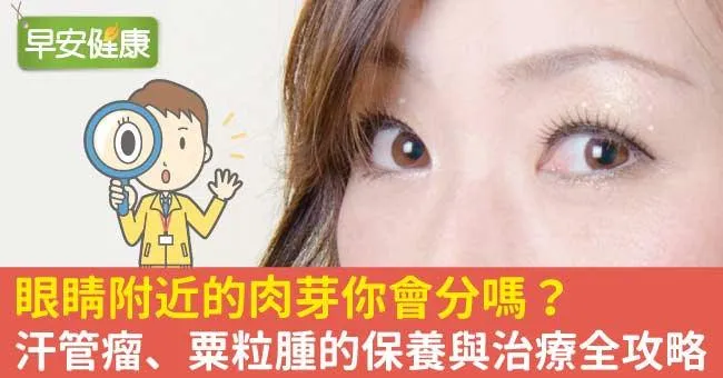 眼睛附近的肉芽你會分嗎？汗管瘤、粟粒腫的保養與治療全攻略