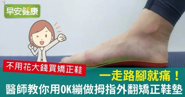 一走路腳就痛！醫師教你用OK繃做拇指外翻矯正鞋墊