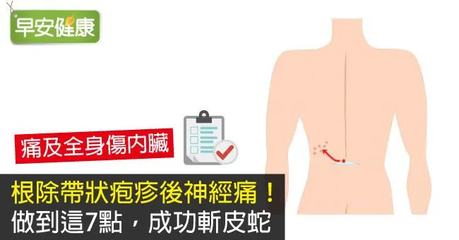 根除帶狀皰疹後神經痛！做到這7點，成功斬皮蛇