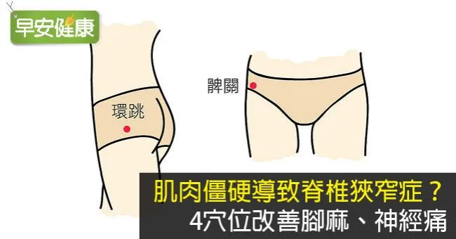肌肉僵硬導致脊椎狹窄症？4穴位改善腳麻、神經痛