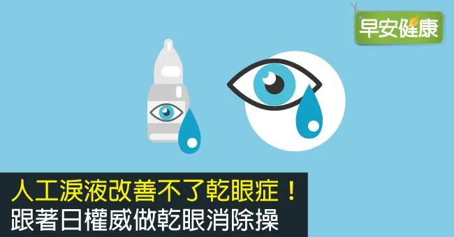 人工淚液改善不了乾眼症！跟著日權威做乾眼消除操