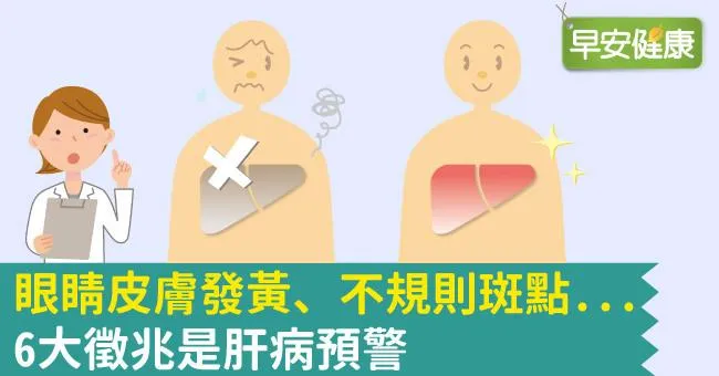 眼睛皮膚發黃、不規則斑點...6大徵兆是肝病預警