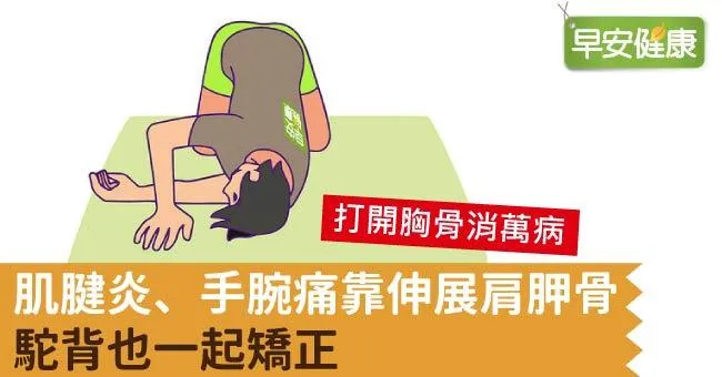 肌腱炎、手腕痛靠伸展肩胛骨，駝背也一起矯正
