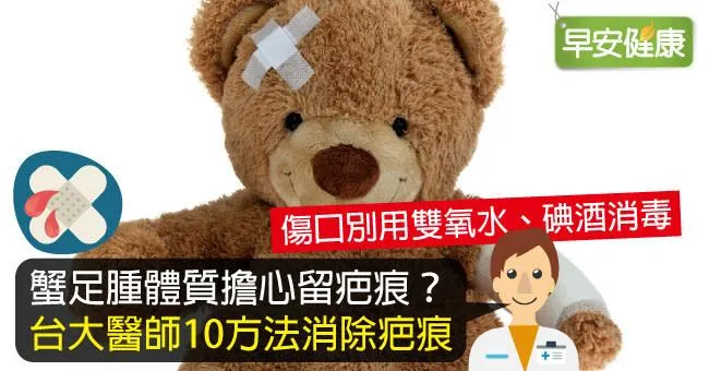 蟹足腫體質擔心留疤痕？台大醫師10方法消除疤痕