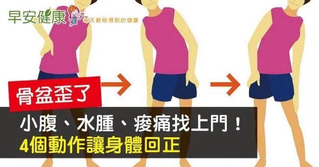 骨盆歪了，小腹、水腫、痠痛找上門！4個動作讓身體回正