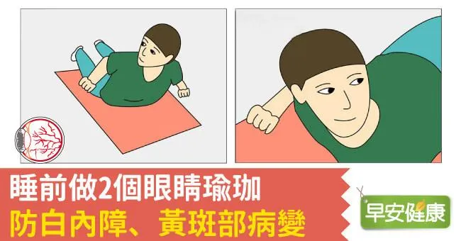 睡前做2個眼睛瑜珈，防白內障、黃斑部病變
