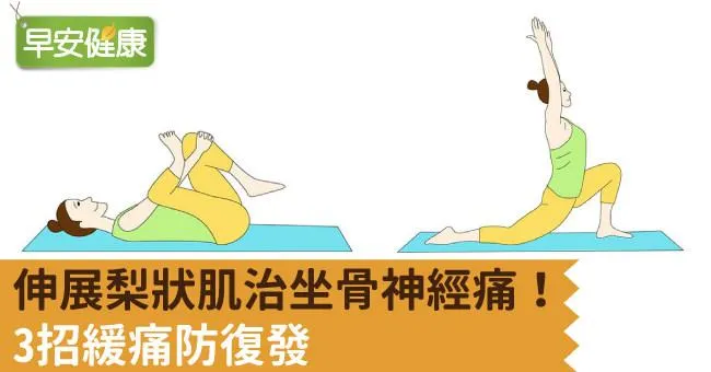 梨狀肌症候群必看的伸展操！舒緩坐骨神經痛防復發