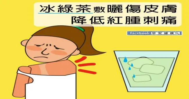 冰綠茶敷曬傷皮膚，降低紅腫刺痛