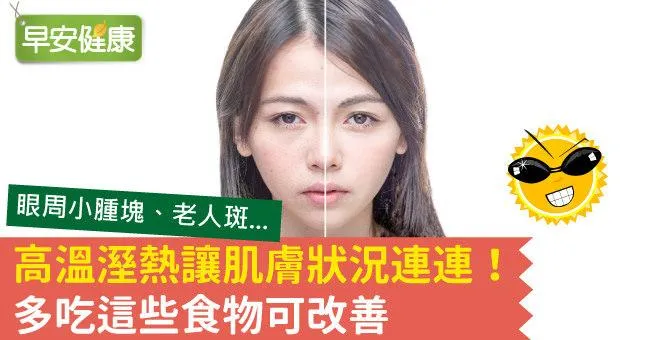 高溫溼熱讓肌膚狀況連連！多吃這些食物可改善