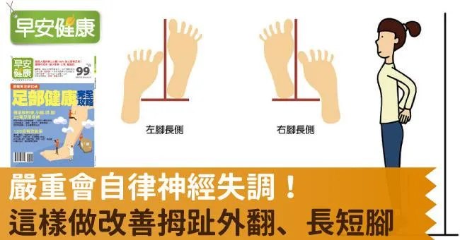 嚴重會自律神經失調！這樣做改善拇趾外翻、長短腳