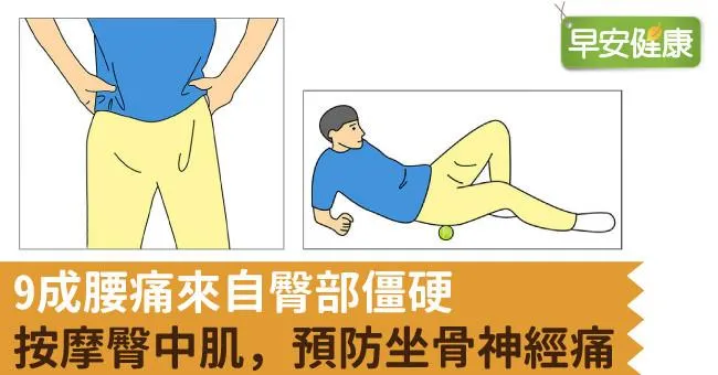 9成腰痛來自臀部僵硬 按摩臀中肌，預防坐骨神經痛