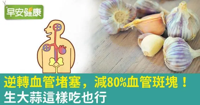 逆轉血管堵塞，減80％血管斑塊！生大蒜這樣吃也行