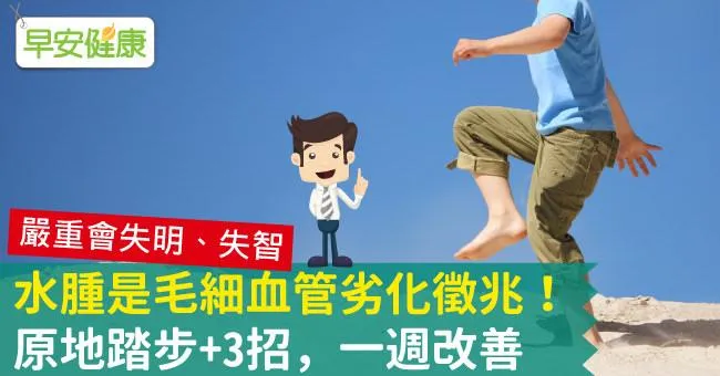 水腫是毛細血管劣化徵兆！原地踏步+3招，一週改善