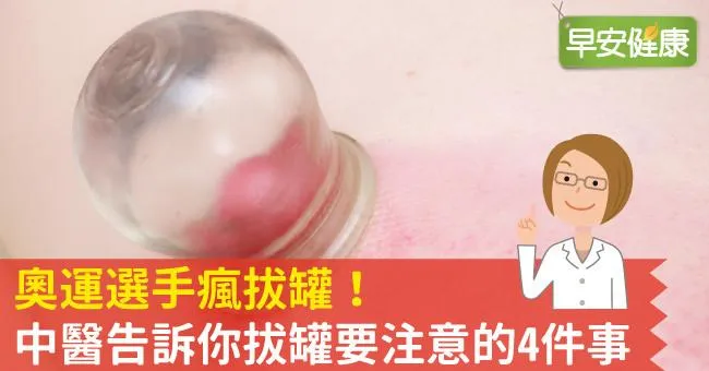 奧運選手瘋拔罐！中醫告訴你拔罐要注意的4件事
