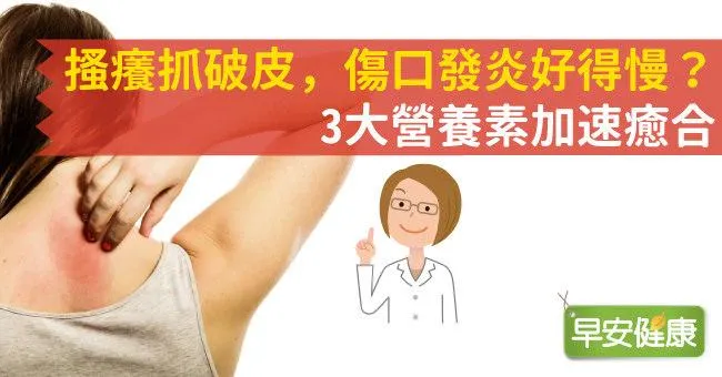 搔癢抓破皮，傷口發炎好得慢？3大營養素加速癒合