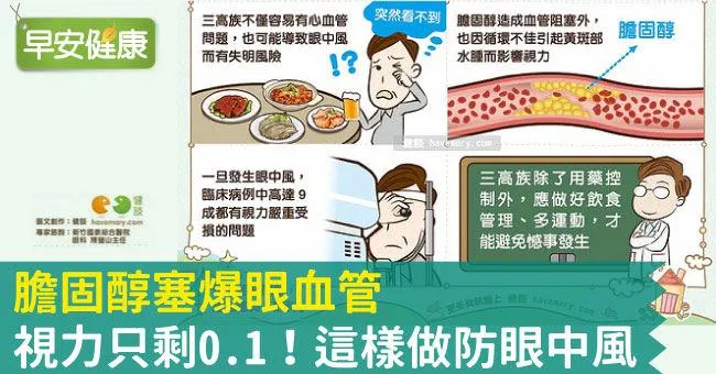 膽固醇塞爆眼血管，視力只剩0.1！這樣做防眼中風