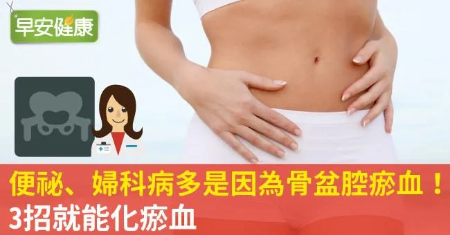 便祕、婦科病多是因為骨盆腔瘀血！3招就能化瘀血