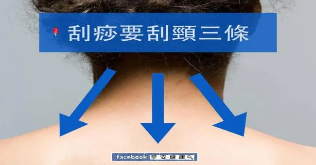 刮痧要刮頸三條