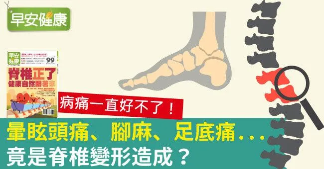 暈眩頭痛、腳麻、足底痛...竟是脊椎變形造成？