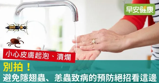 別拍！避免隱翅蟲、恙蟲致病的預防絕招看這邊