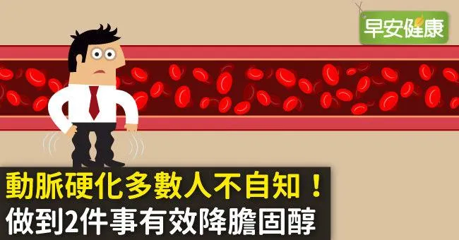 動脈硬化多數人不自知！做到2件事有效降膽固醇