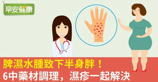 脾濕水腫致下半身胖！6中藥材調理，濕疹一起解決