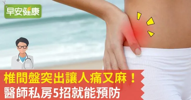 椎間盤突出讓人痛又麻！醫師私房5招就能預防