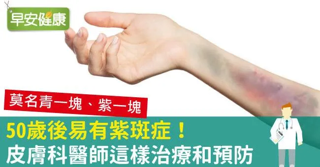 50歲後，紫斑症找上門！手臂莫名瘀青，紫斑症如何改善？