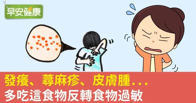發癢、蕁麻疹、皮膚腫...多吃這食物反轉食物過敏
