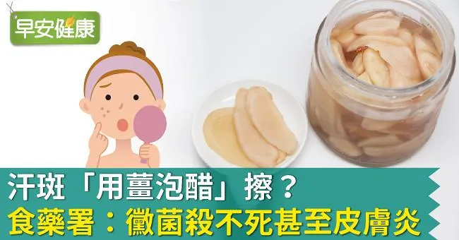 汗斑「用薑泡醋」擦？食藥署：黴菌殺不死甚至皮膚炎！