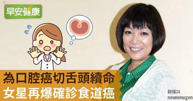 為口腔癌切舌頭續命！女星再爆確診食道癌