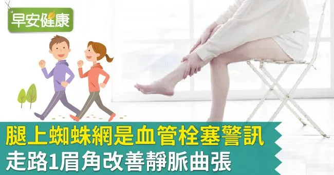 腿上蜘蛛網是血管栓塞警訊！走路1眉角改善靜脈曲張