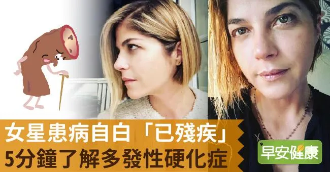 女星患病自白「已殘疾」，5分鐘了解多發性硬化症