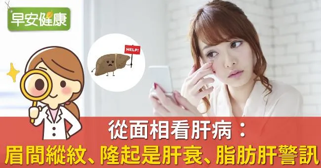 從面相看肝病：「眉間縱紋、隆起」是肝衰、脂肪肝警訊！
