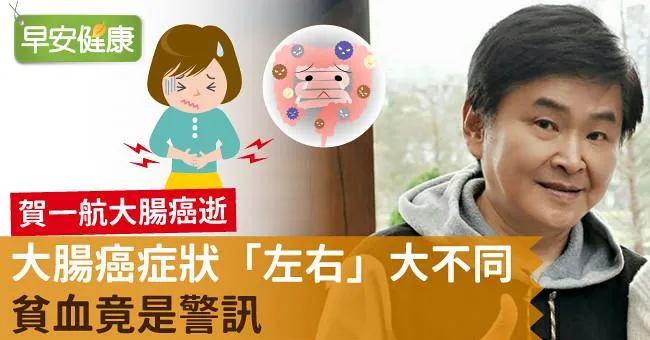 賀一航大腸癌逝，大腸癌症狀「左右」大不同，貧血竟是警訊