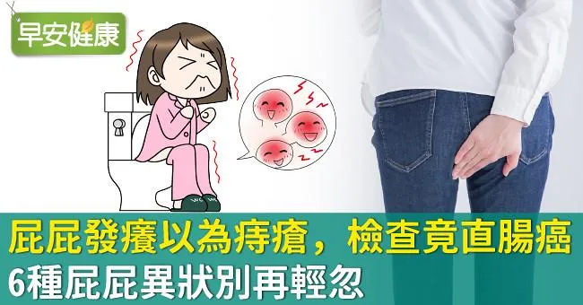 「屁屁發癢」以為痔瘡，檢查竟直腸癌！6種屁屁異狀別再輕忽