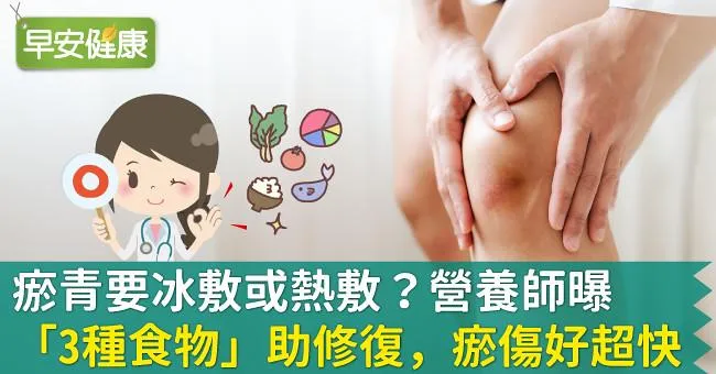 瘀青要冰敷或熱敷？營養師曝「3種食物」助修復，瘀傷好超快
