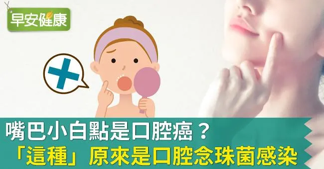 身體不健康，口腔也知道！認識口腔念珠菌症