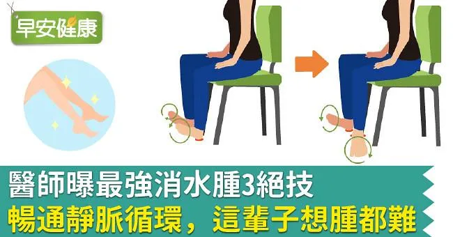 醫師曝最強消水腫3絕技，暢通靜脈循環，這輩子想腫都難