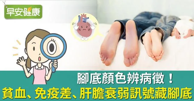 腳底顏色辨病徵！貧血、免疫差、肝膽衰弱訊號藏腳底！