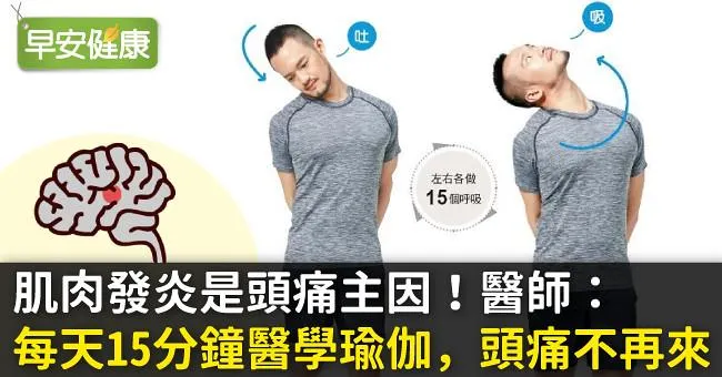 肌肉發炎是頭痛主因！醫師：每天15分鐘醫學瑜伽，頭痛不再來
