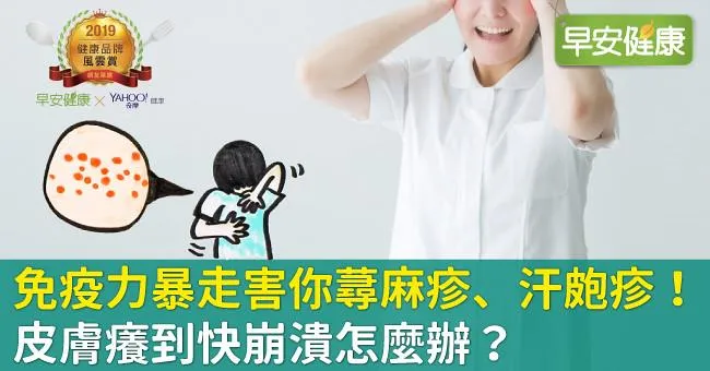免疫力暴走害你蕁麻疹、汗皰疹！皮膚癢到快崩潰怎麼辦？
