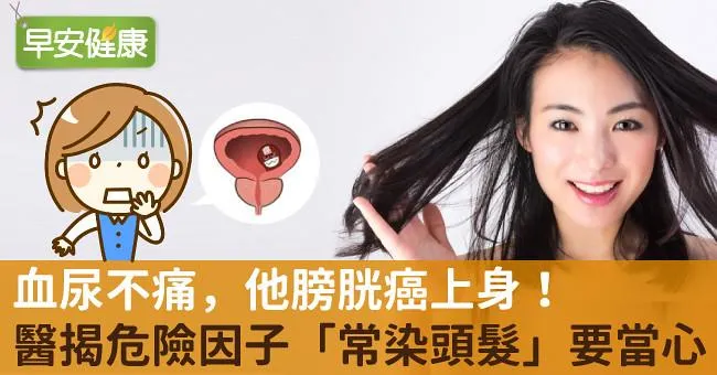 血尿不痛，他膀胱癌上身！醫揭危險因子「常染頭髮」要當心