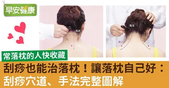 刮痧也能治落枕！讓落枕自己好：刮痧穴道、手法完整圖解